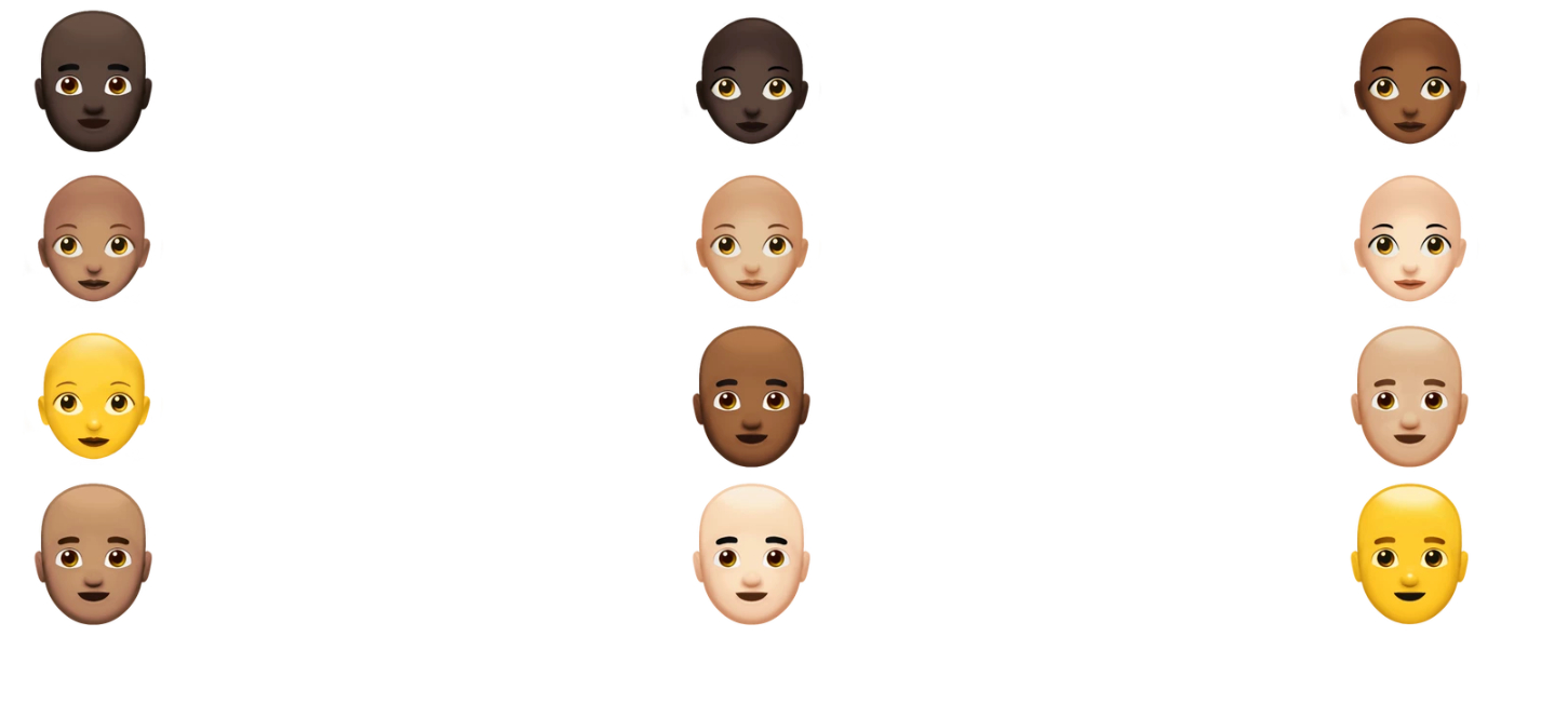 Стартап MyHair AI хочет изменить подход к диагностике облысения с помощью собственных ИИ-моделей